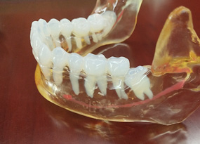 牙齿医学模型