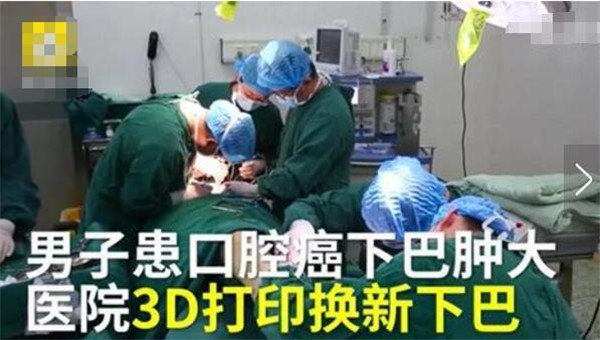 “医生用3D打印为患者换下新下巴”上了微博热搜？这是怎么回事？！