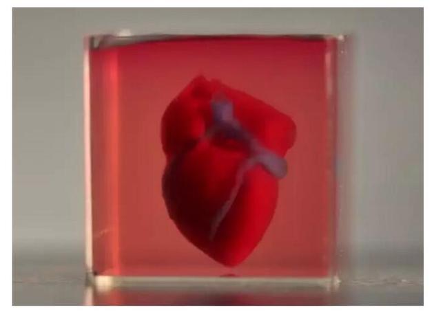 全球首例3D打印完整心脏问世！