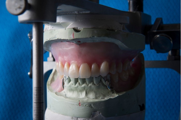 德克萨斯州使用3D打印技术为犯制造假牙
