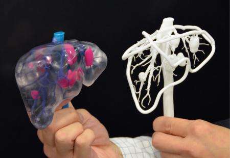 3D生物打印血管将可模拟人体肾脏功能