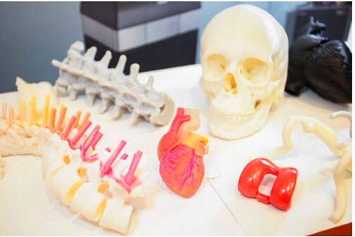 3D打印模型助力医疗行业