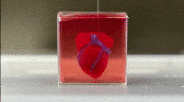 观3D打印心脏突破，这项黑科技会否成为透析肾友肾移植的希望？